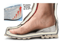 Btall Arch Support